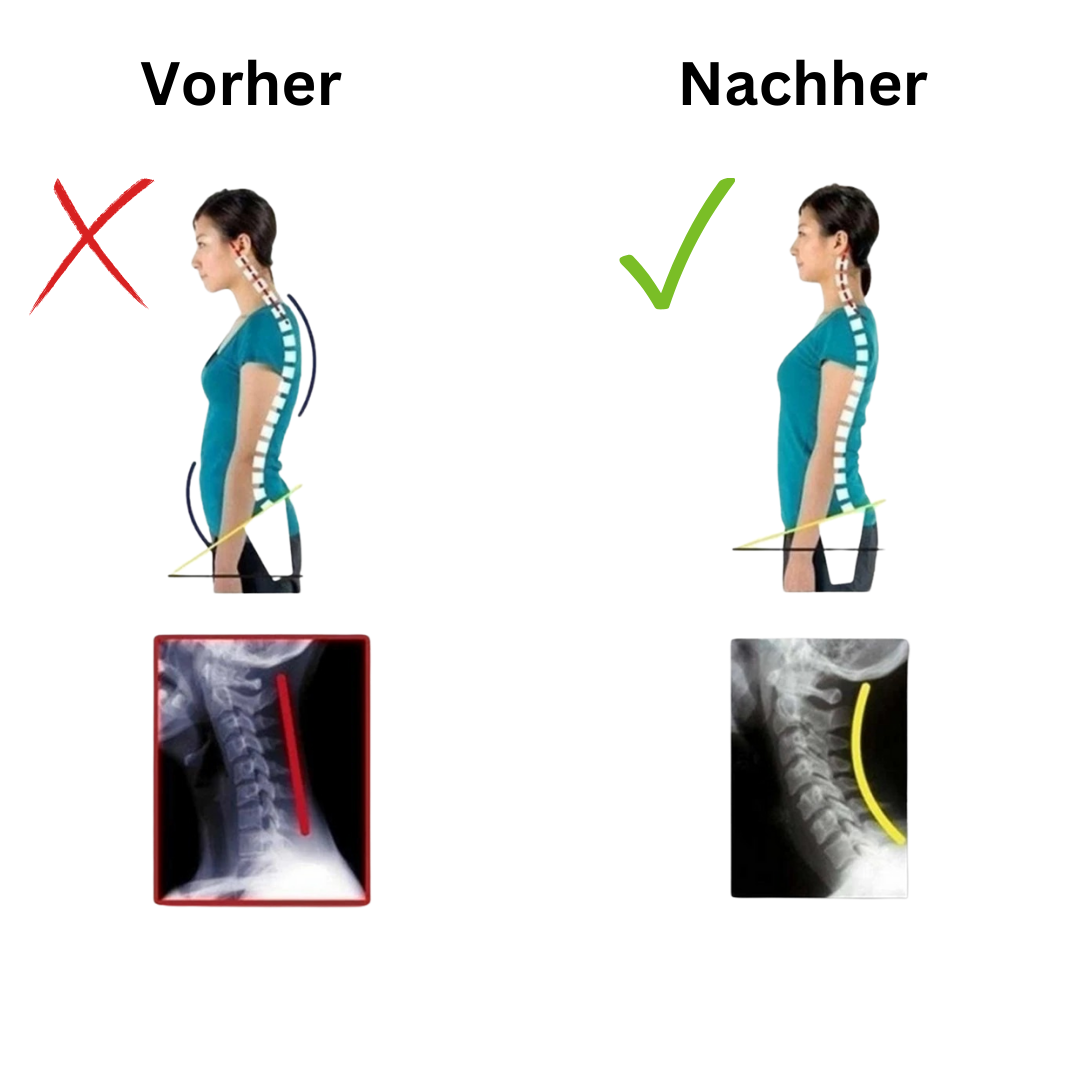 SpinaSana™ Haltungskorrektur